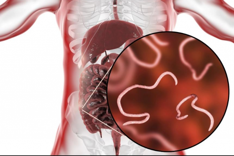 Health Benefits of Deworming StocksWatch